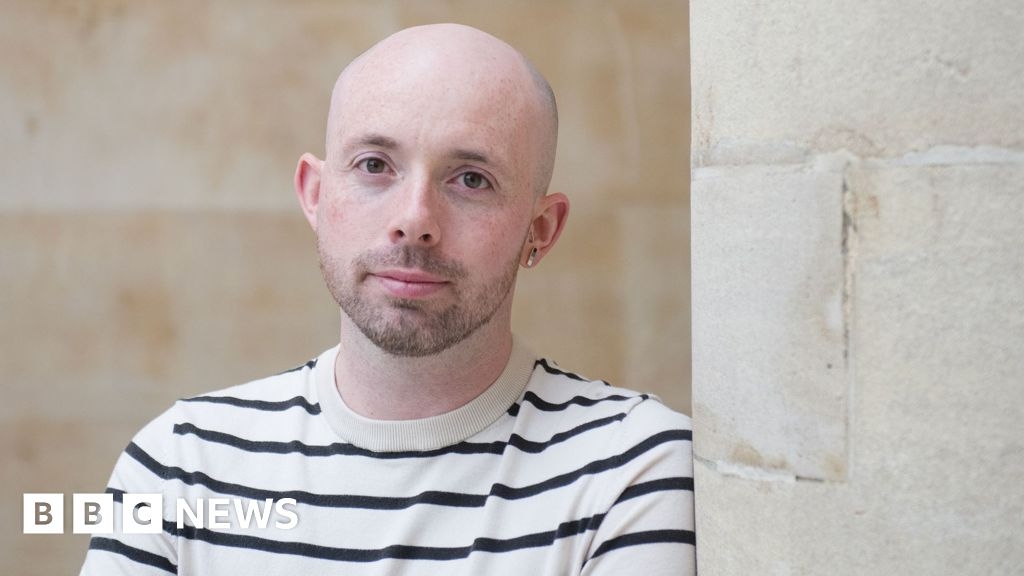 Mit 21 Jahren traf mich der Witz eines Fremden über meine beginnende Glatze wie ein Schlag. Danach veränderte sich meine Sicht auf mich selbst.