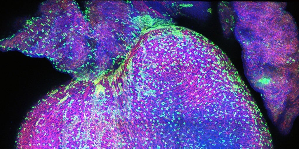 Bu harita, insan kalbinin doğum öncesi gelişimi sırasında nasıl göründüğünü açıklıyor.
