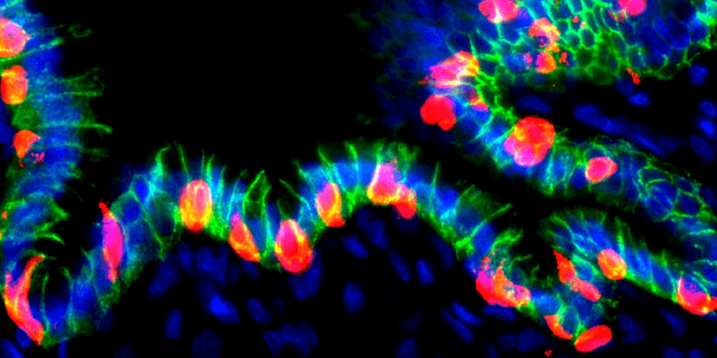 Herprogrammeerde maagcellen produceren insuline om diabetes te behandelen