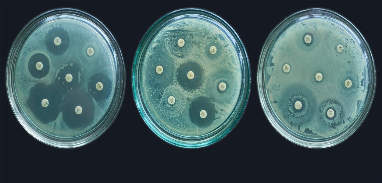 WHO: Antibioticaresistentie neemt wereldwijd aanzienlijk toe