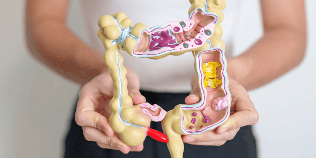 Como os antibióticos podem aumentar o risco de câncer colorretal